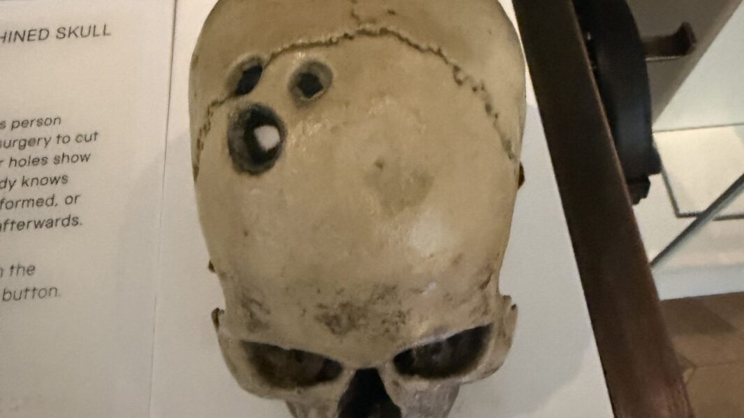skull with two gun shots in the head